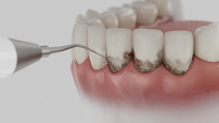 Trusted Tooth Extraction service in Agoura Hills, CA - Dentist Open Now
